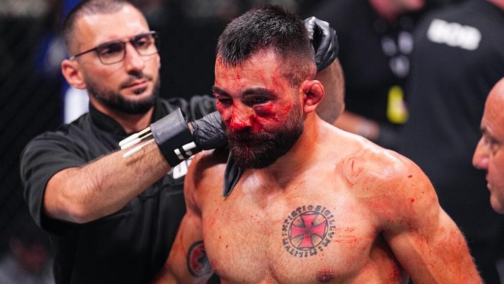 nxnoticias.com-ufc-moicano-sorprende-a-saint-denis-y-arrasa-en-paris